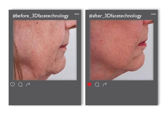 3dfacetechnology_enthesi_2