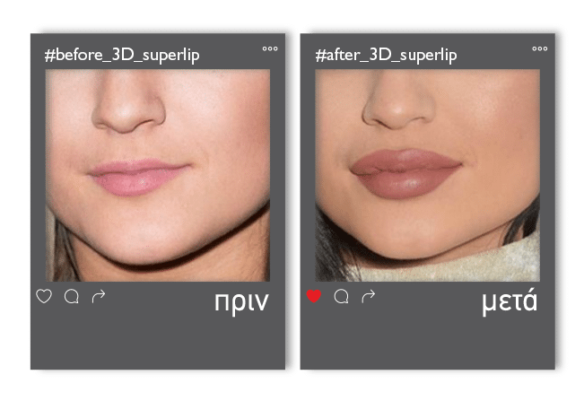 3Dsuperlip_v4