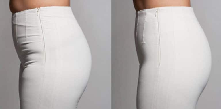 BEFORE-AFTER-1-768x379