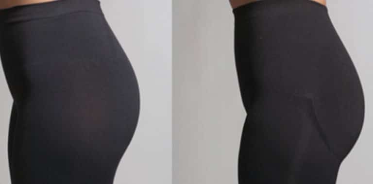 BEFORE-AFTER-3-768x379