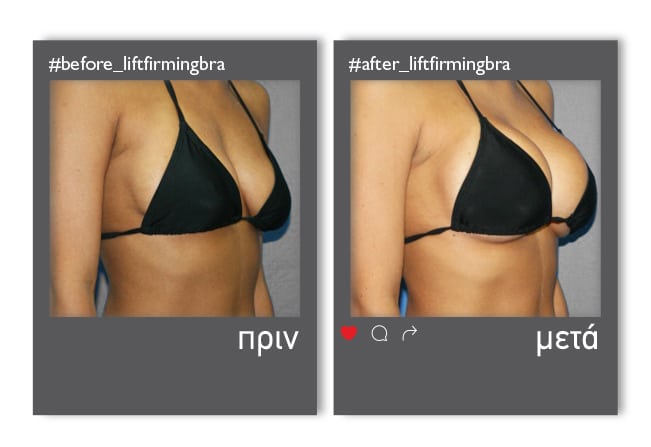 LiftFirmingBra_enthesi_3