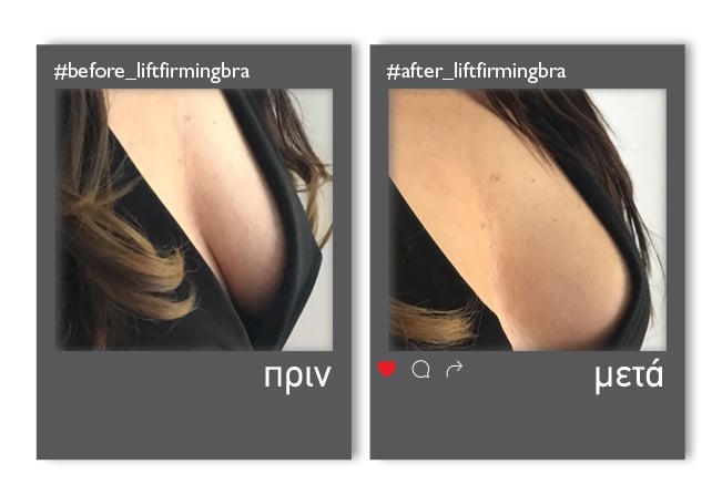 LiftFirmingBra_enthesi_4