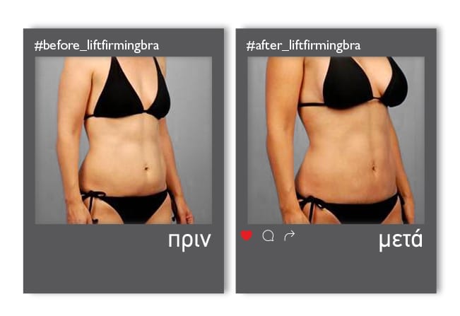 LiftFirmingBra_enthesi_5