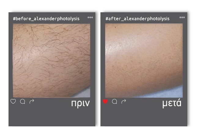 prinmetamaster-1-min