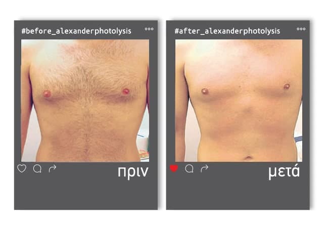 prinmetamaster-2-min