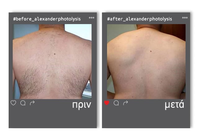 prinmetamaster-3-min