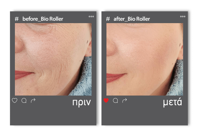 Before_After roller2