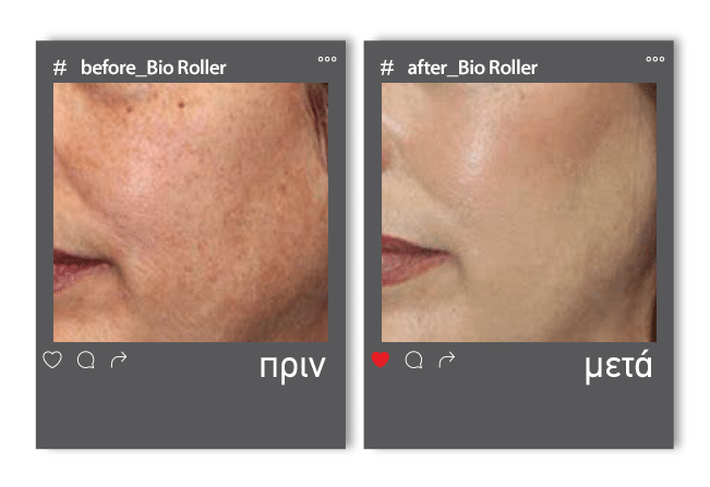 Before_After roller3