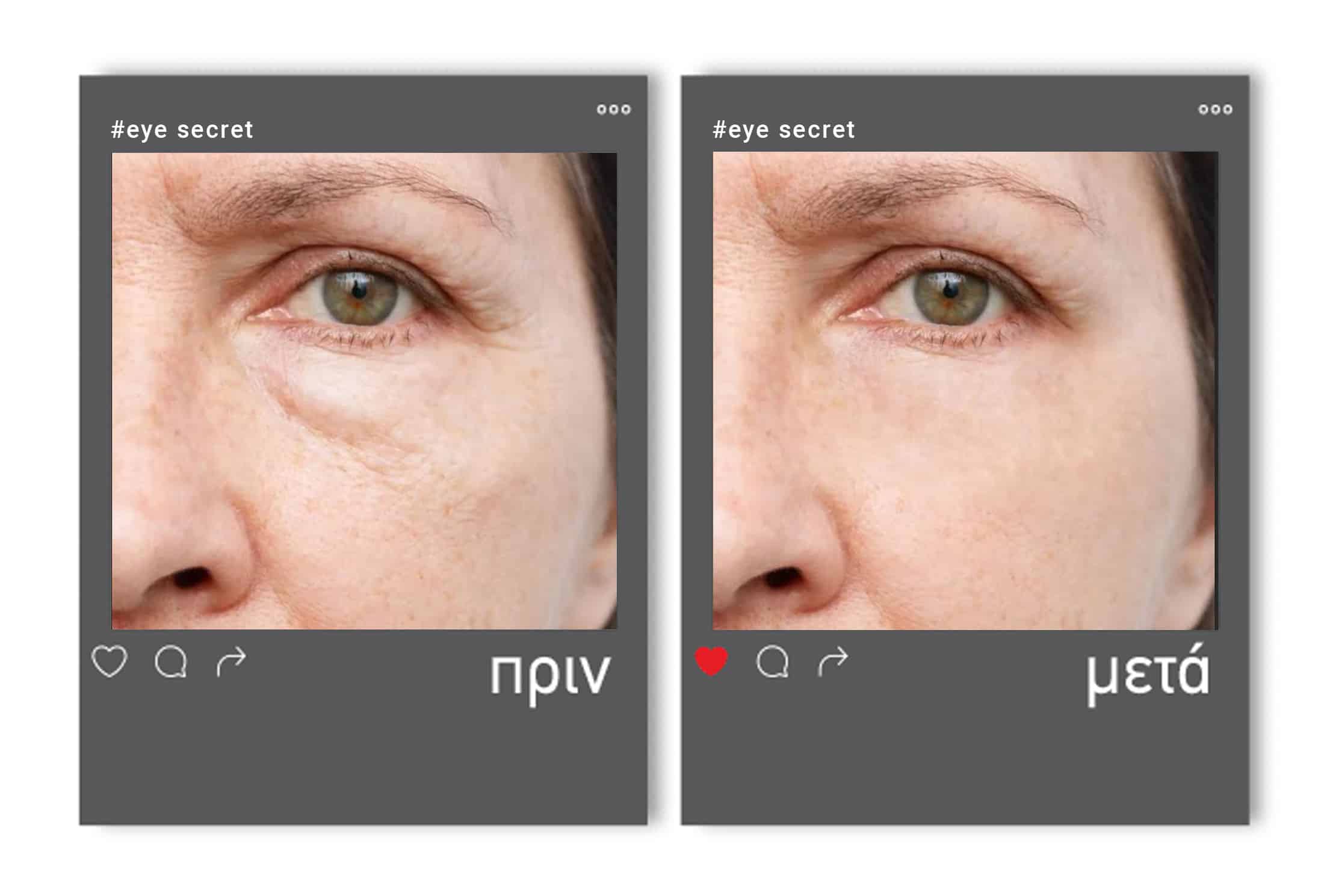 beforeafter_3