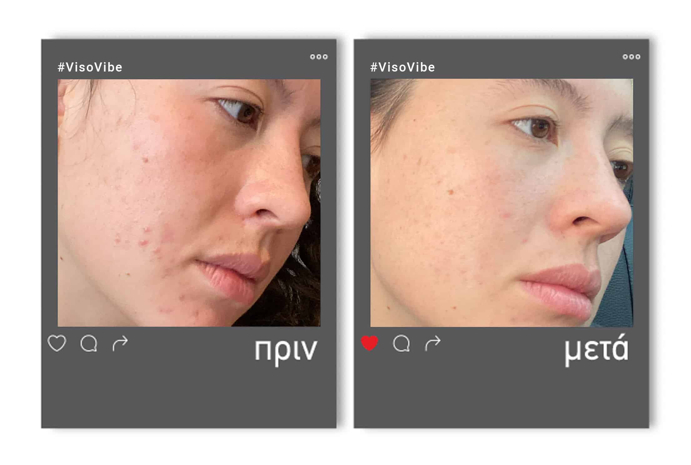 beforeafter_1