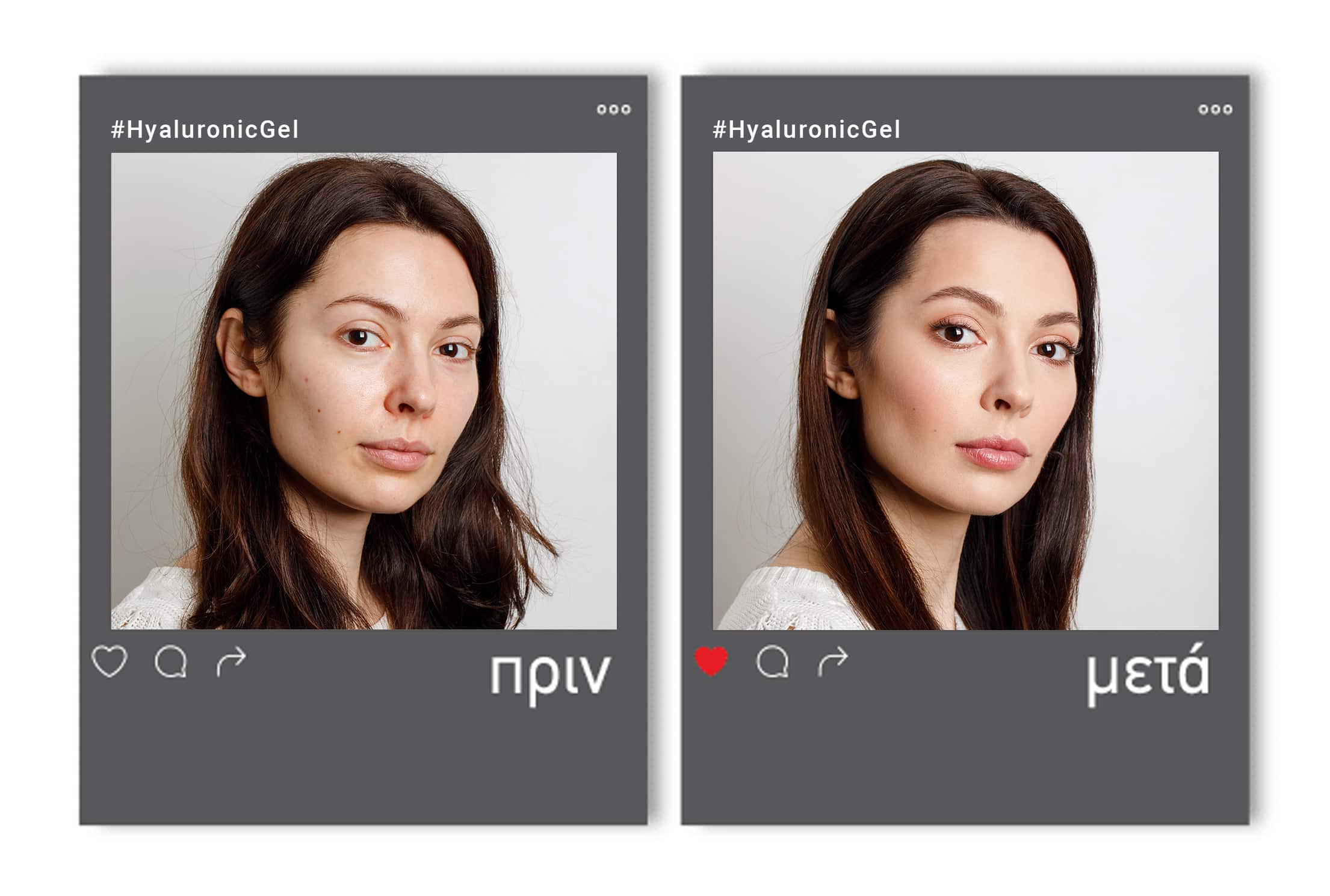 beforeafter_mockup